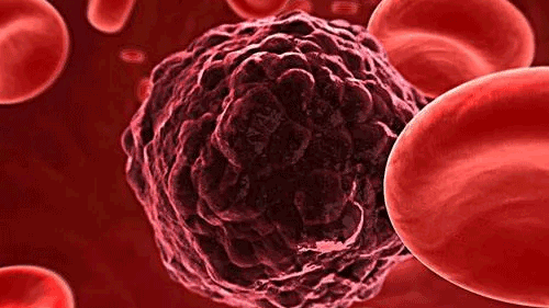 Umbilical Cord Blood Reinvents the Miracle of Life! Cord Blood Saved for Son 9 Years Ago Brings 49-Year-Old Mom Back from the Dead